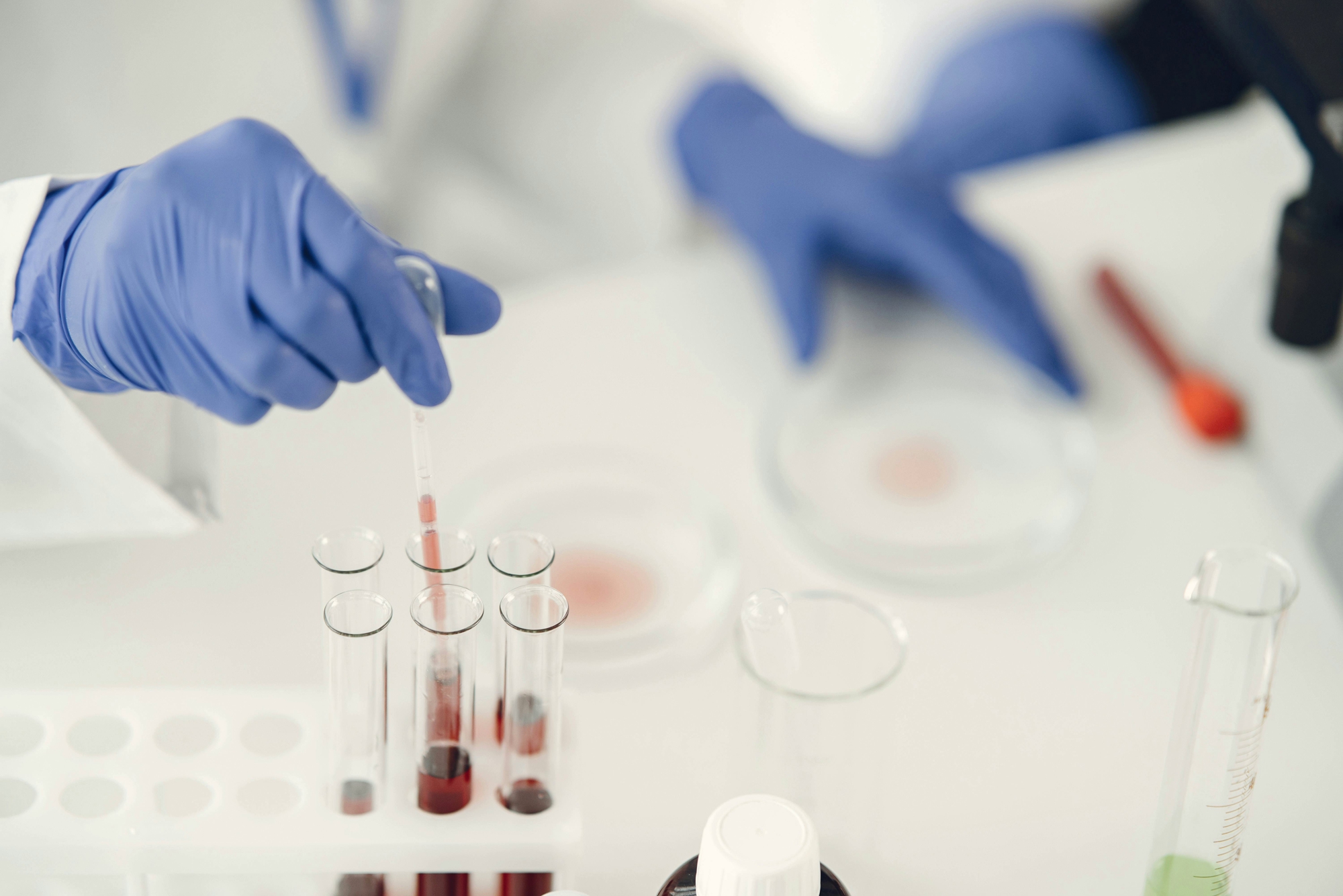 Bradavice izazvane HPV-om: Njihova prevencija i lečenje