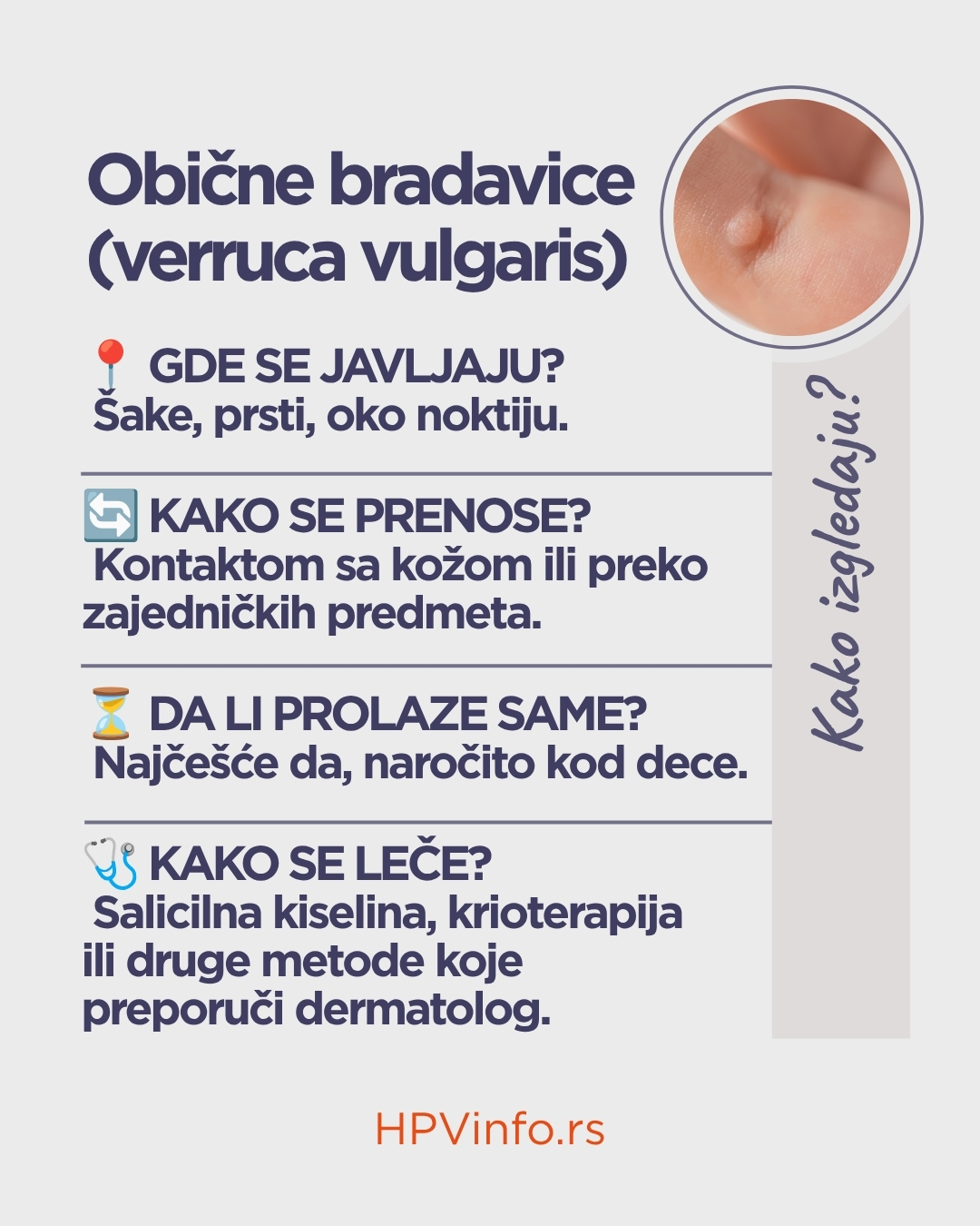 Obične bradavice